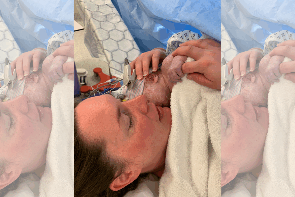 mum and baby after a c-section