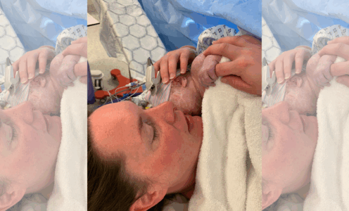 Are you prepared for having a C-section?