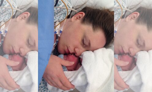 Ways you can make your C-section positive